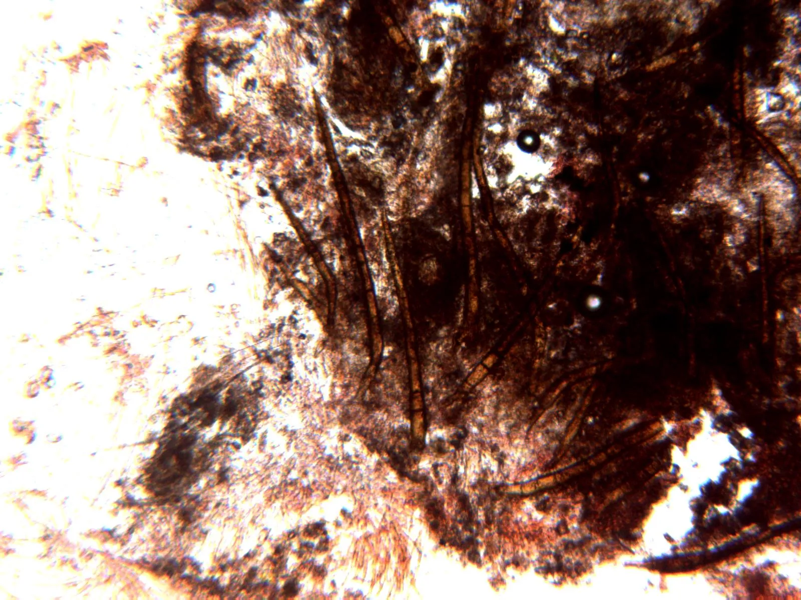 Microscopía de Scutellinia subhirtella - 16 - Pelos x 100 2